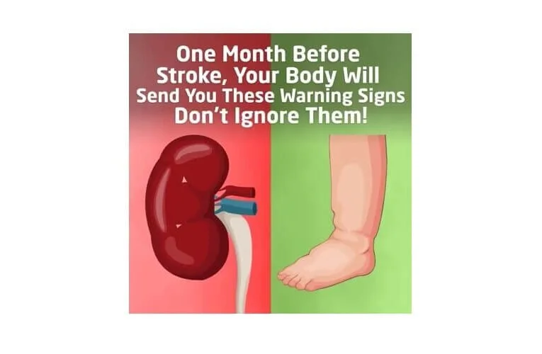 Warning Signs One Month Before Stroke